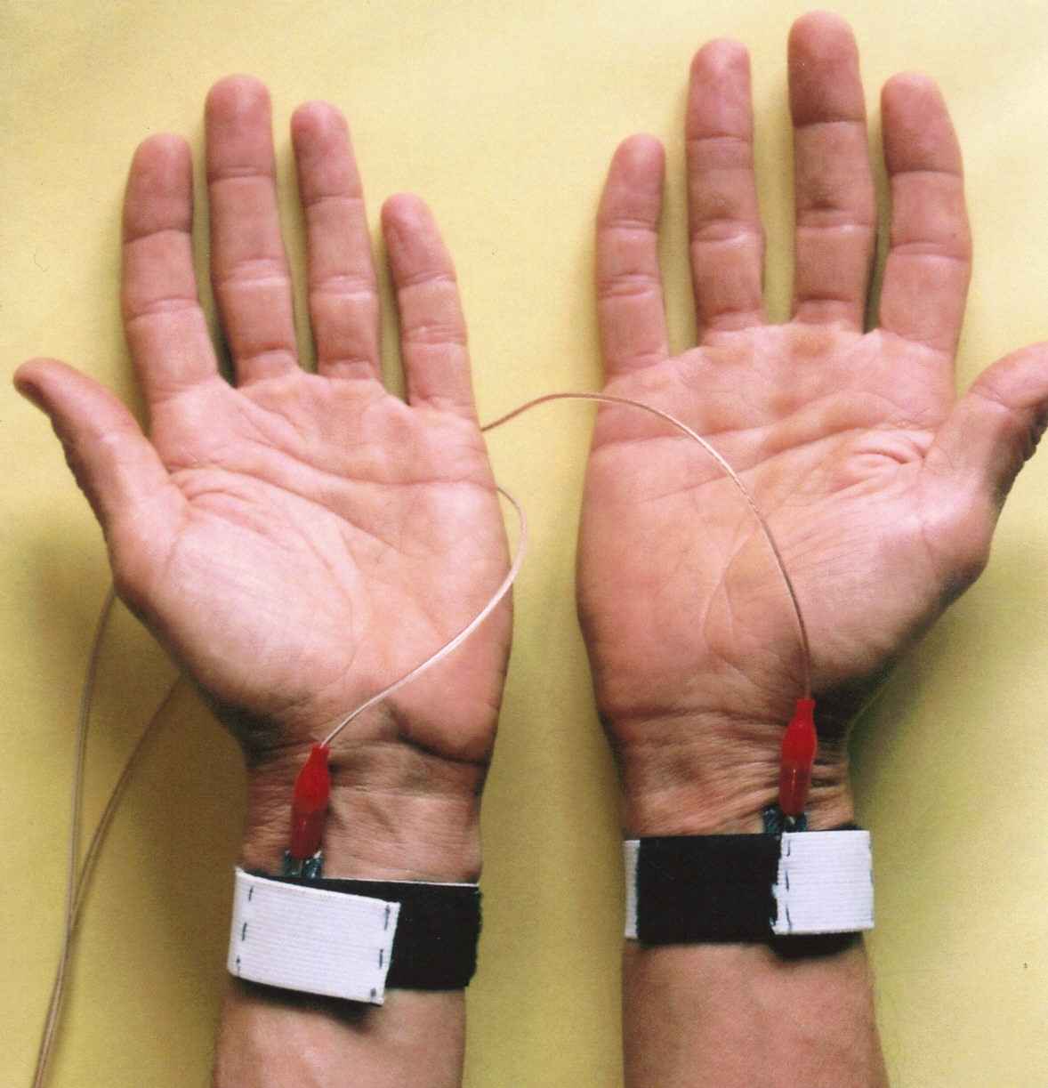 picture of electrodes attached to wrist