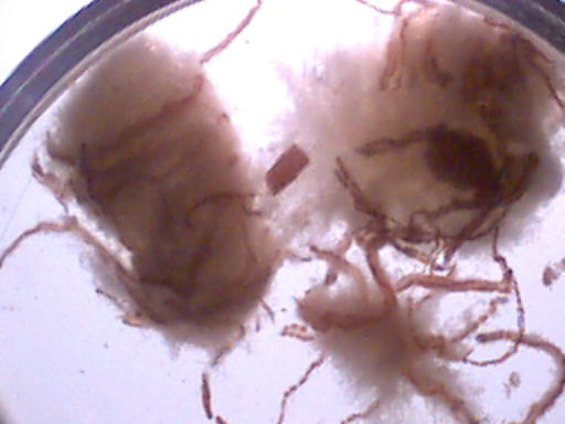 http://www.altcancer.com/images/egg14.jpg